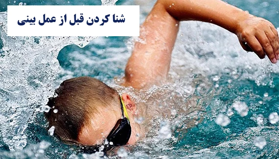 شنا کردن قبل از عمل بینی