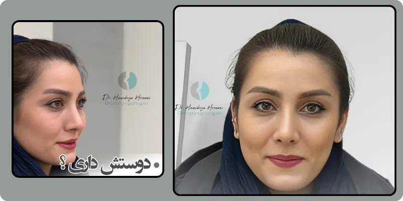 خطرات عمل ترمیمی بینی