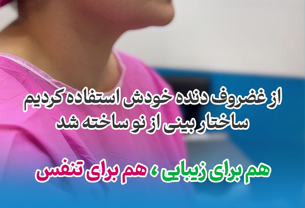 تقویت غضروفی