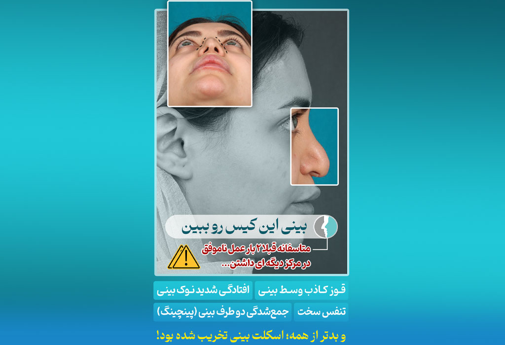 کیس بینی ترمیمی