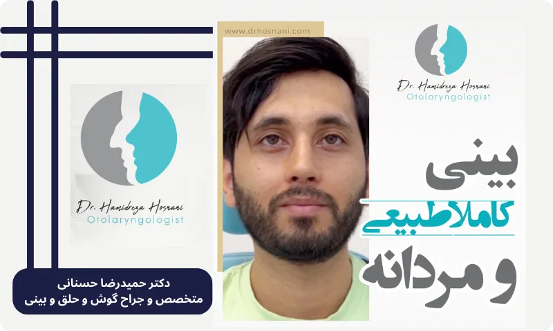 جراحی بینی مردانه
