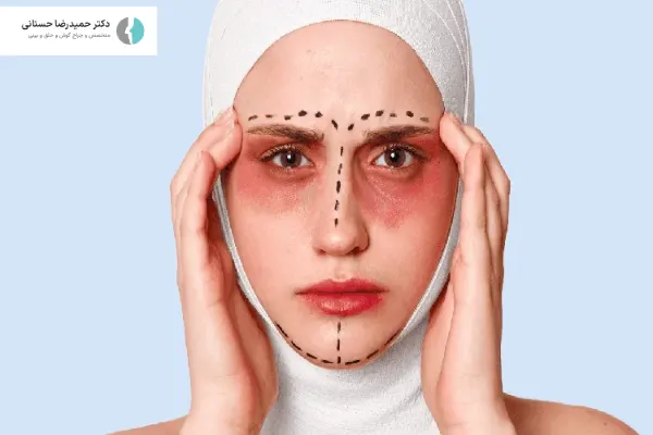 علت کبودی بعد از عمل بینی