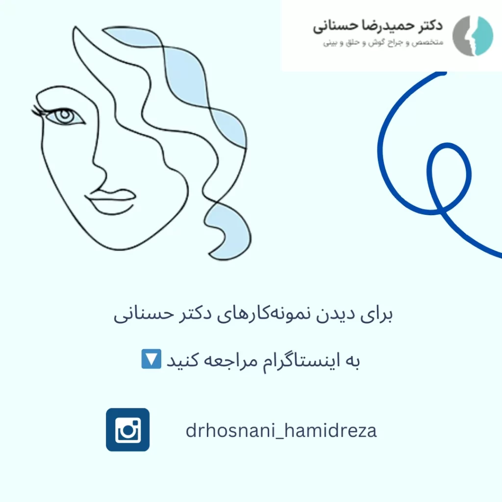 نمونه عمل بینی شرقی