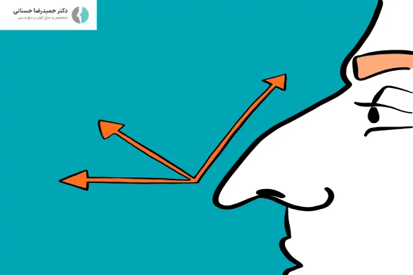 ترمیم افتادگی نوک بینی