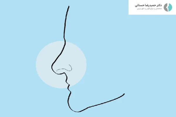 علت افتادگی نوک بینی