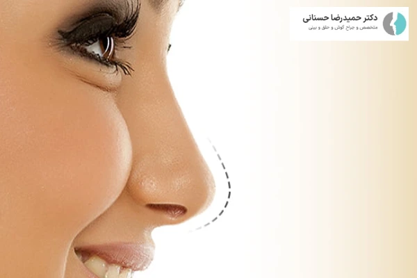 بهترین فصل عمل بینی چه زمانی است؟