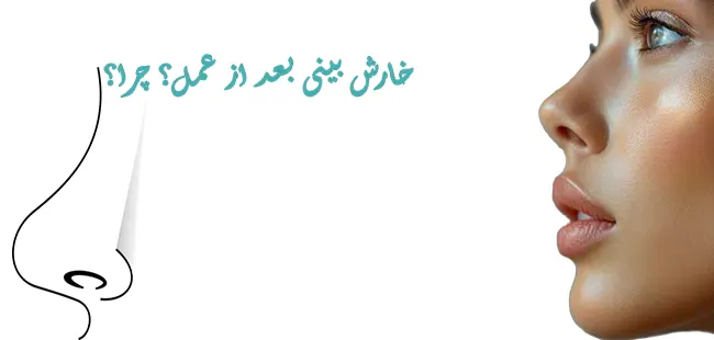 خارش بینی بعد از عمل