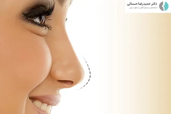 مراحل عمل پره های بینی