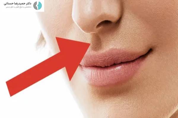 انواع مشکلات تنفسی بعد از عمل بینی