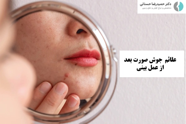 علائم جوش صورت بعد از عمل بینی