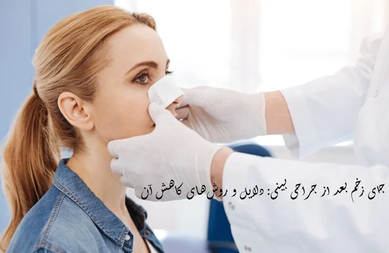 جای زخم بعد از جراحی بینی