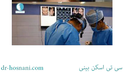 سی تی اسکن بینی
