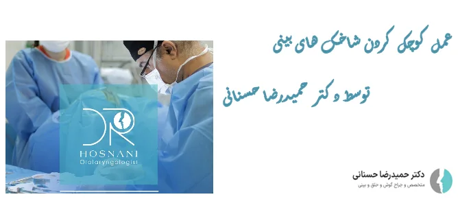 عمل کوچک کردن شاخک های بینی