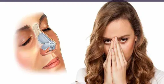 فین کردن بعد از جراحی بینی