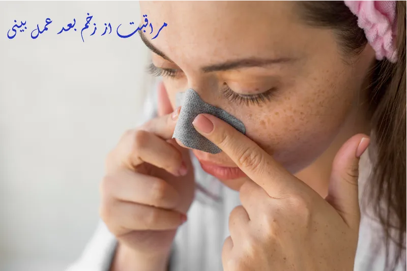 مراقبت از زخم بعد عمل بینی