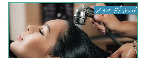 نحوه دوش گرفتن بعد از عمل بینی