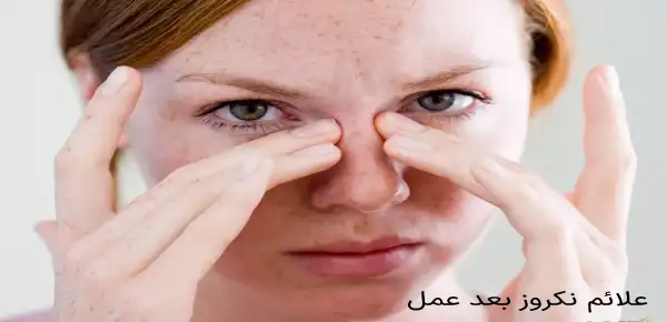 علائم نکروز بعد عمل
