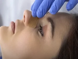 برگشت فرم بینی گوشتی
