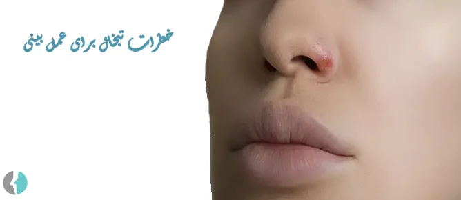 خطرات تبخال برای عمل بینی