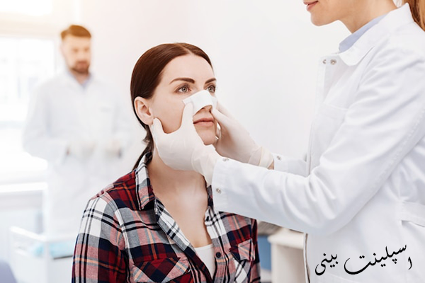 اسپلینت بینی بعد عمل