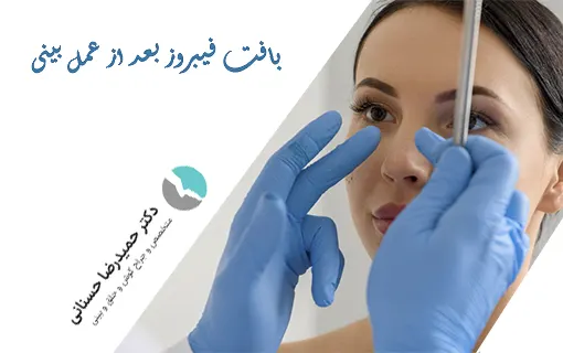 بافت فیبروز بعد از عمل بینی