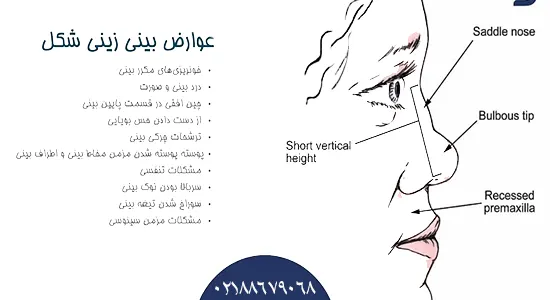 عوارض بینی زینی شکل