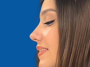 جراحی بینی استخوانی