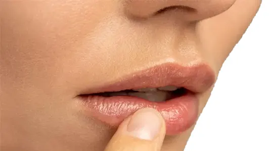 بی حسی لب بالا بعد از عمل بینی