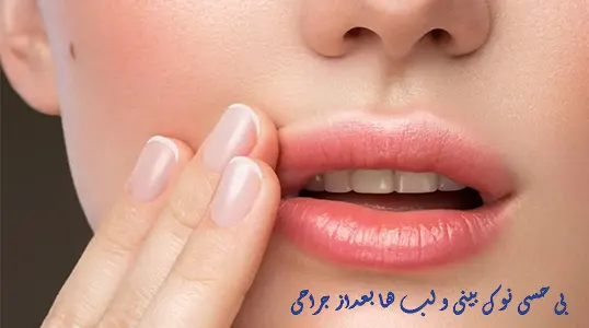 بی حسی نوک بینی بعد از جراحی