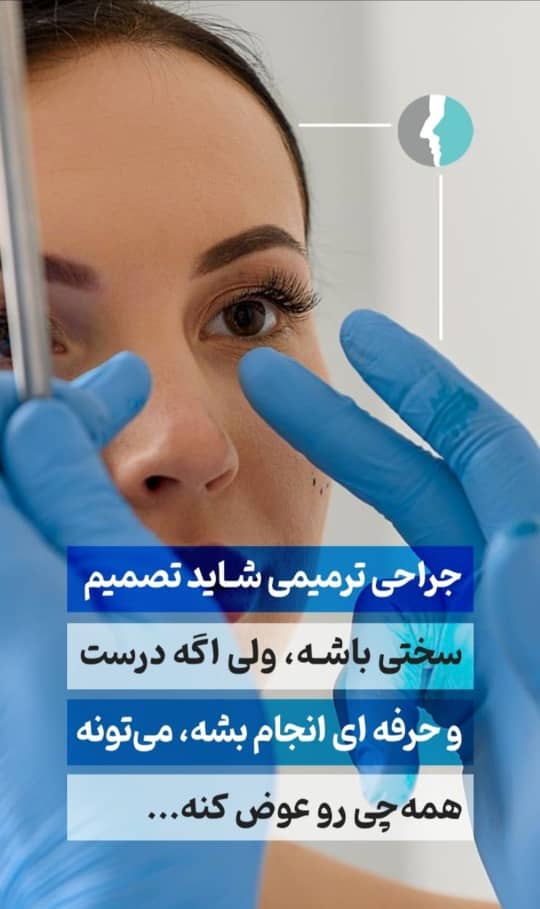 جراحی ترمیمی بینی شاید تصمیم سختی باشه