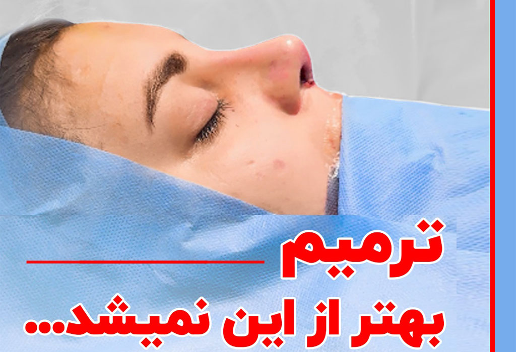 بهترین نتیجه ترمیم بینی