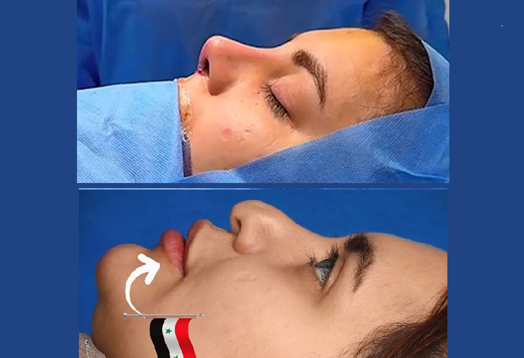 نمونه جراحی ترمیمی