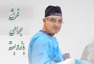 فرق عمل باز و بسته