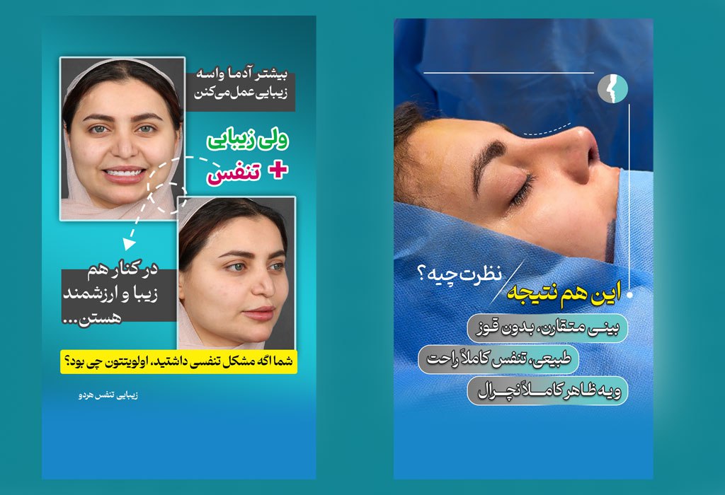 جراحی بینی ترمیمی