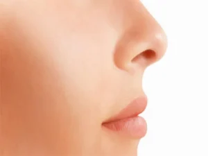 بی حسی نوک بینی