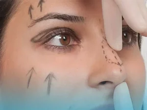 نکات موثر در نتیجه عمل بینی