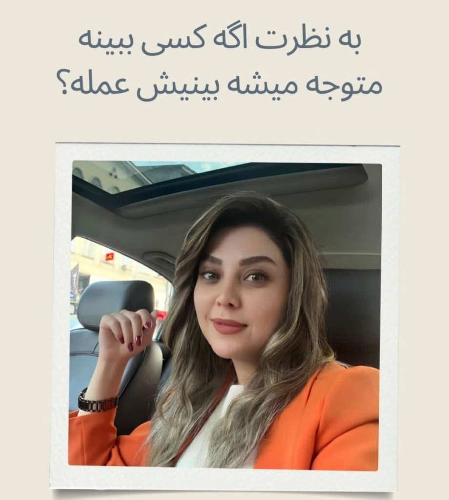 جراحی بینی طبیعی توسط دکتر حسنانی