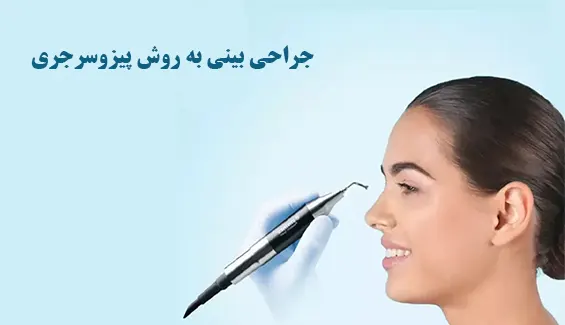 جراحی بینی به روش پیزوسرجری