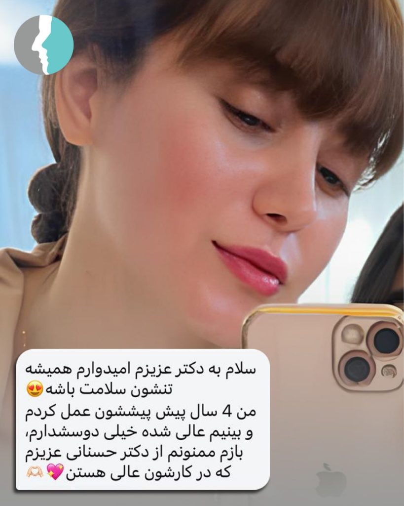 نتیجه جراحی بینی طبیعی بعد از 4 سال