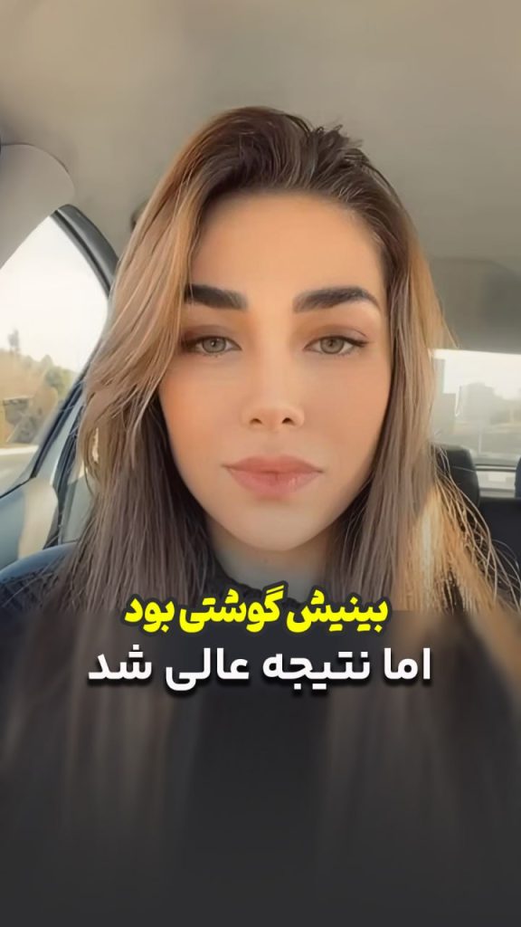 بینی گوشتی طبیعی