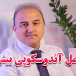 آندوسکوپی
