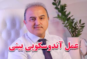 آندوسکوپی بینی