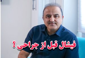 فیشال قبل از عمل