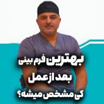بهترین فرم بینی