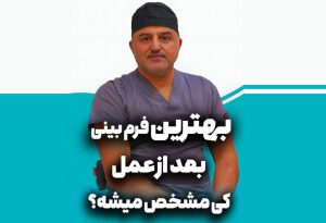 بهترین فرم بینی
