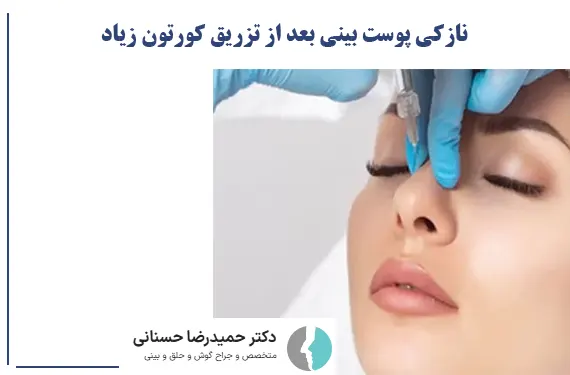 نازکی پوست بینی بعد از تزریق کورتون زیاد
