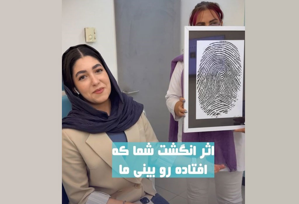 اثر انگشت شما بر روی بینی ما