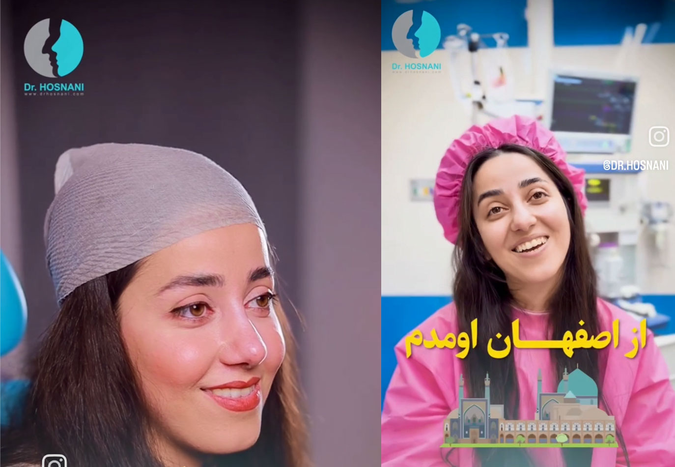 نگین از اصفهان با بینی گوشتی