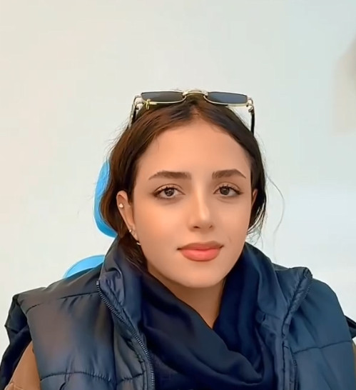 شبیه کندال جنر