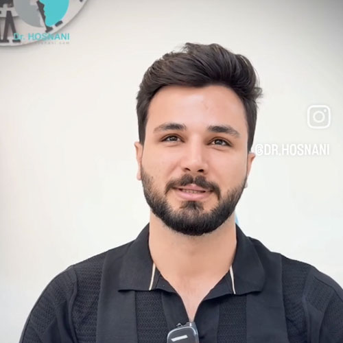 جراحی بینی طبیعی برای آقایان